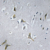 2 - Anti-NDUFC1 Antibody AP54043