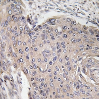 2 - Anti-SPTBN5 Antibody AP54052