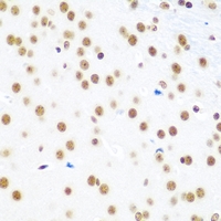 2 - Anti-EVI1 Antibody AP54063
