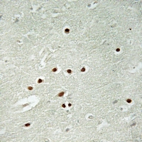 2 - Anti-ANKRD26 Antibody AP54070