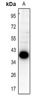 1 - Anti-SLM2 Antibody AP54075