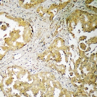 2 - Anti-ADAMTS16 Antibody AP54098