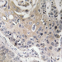 2 - Anti-CCP3 Antibody AP54100