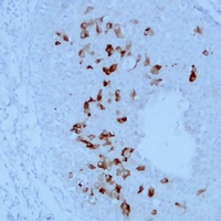 2 - Anti-Mammaglobin-A/B Antibody AP54146