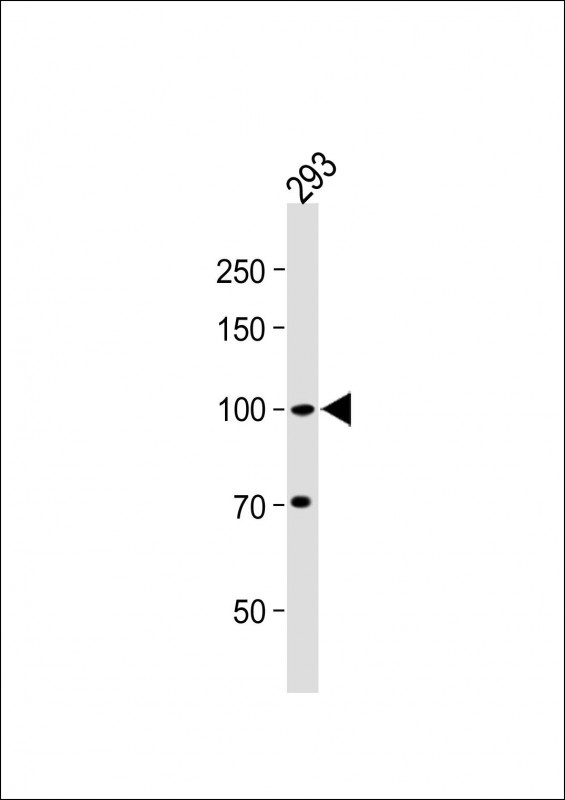 1 - PKN beta Antibody (C-term) AP7935a