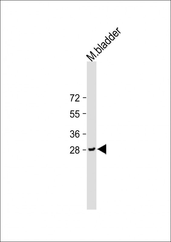 1 - UPK1B Antibody (Center) AP9725c