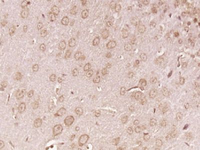 14 - ABCD2 Polyclonal Antibody AP54296