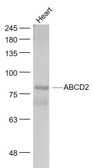 1 - ABCD2 Polyclonal Antibody AP54296