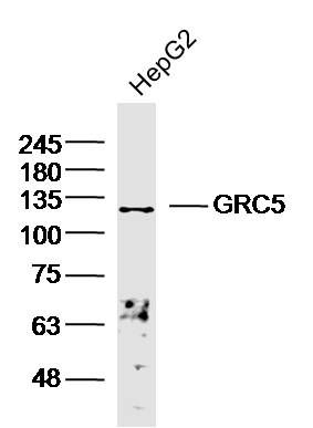 1 - GRC5 Polyclonal Antibody AP54585