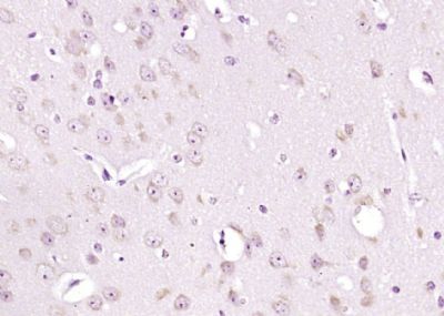 14 - SPOCK2 Rabbit pAb AP54690