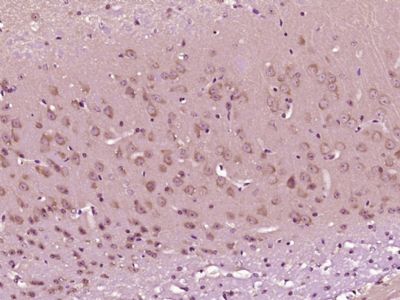 14 - SMEK1 Rabbit pAb AP54914