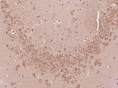 14 - SMEK1 Rabbit pAb AP54914