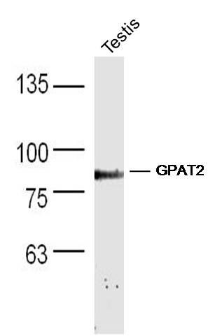 1 - GPAT2 Polyclonal Antibody AP55182
