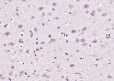 14 - GPAT2 Polyclonal Antibody AP55182