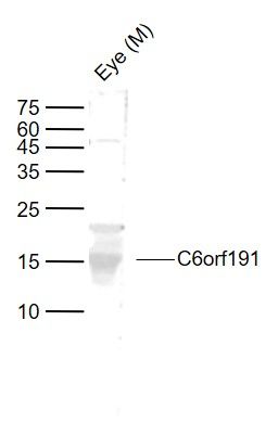 1 - C6orf191 Polyclonal Antibody AP55886