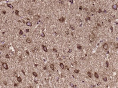 14 - C6orf206 Polyclonal Antibody AP55891