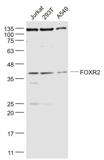 1 - FOXR2 Polyclonal Antibody AP56164