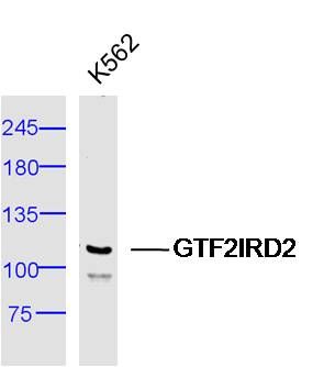 1 - GTF2IRD2 Rabbit pAb AP56228