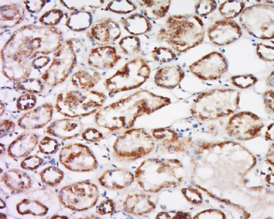 14 - Trehalase Polyclonal Antibody AP56370