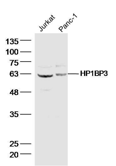 1 - HP1BP3 Polyclonal Antibody AP56677