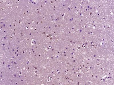 14 - HP1BP3 Polyclonal Antibody AP56677