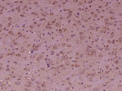 14 - OSBPL6 Polyclonal Antibody AP56729