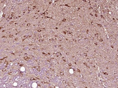 14 - OSBPL6 Polyclonal Antibody AP56729