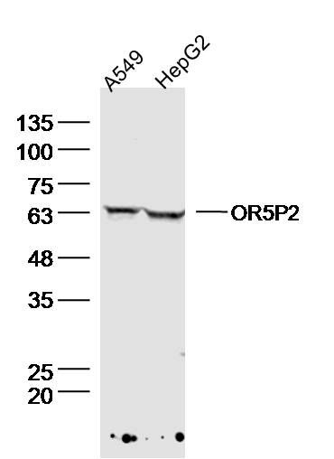 1 - OR5P2 Polyclonal Antibody AP56912
