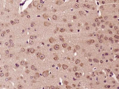 14 - LMBRD1 Polyclonal Antibody AP57032