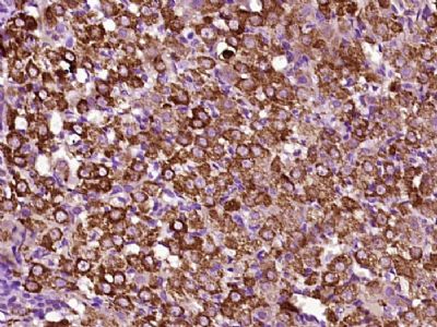 14 - PRSS35 Polyclonal Antibody AP57522