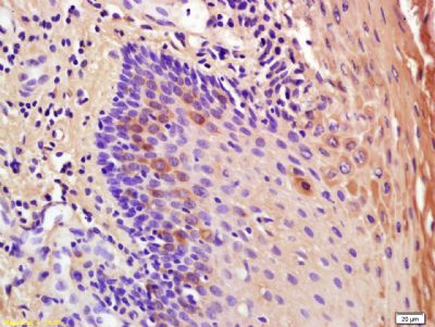 14 - IL-1RA Polyclonal Antibody AP57980