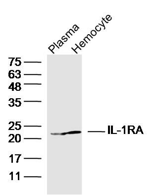 1 - IL-1RA Polyclonal Antibody AP57980