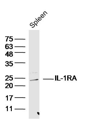 1 - IL-1RA Polyclonal Antibody AP57980