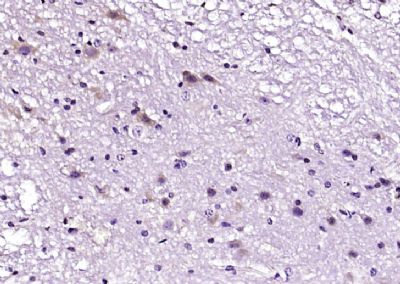 14 - IL-1RA Polyclonal Antibody AP57980
