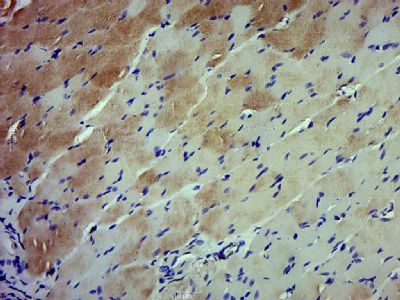 14 - Growth hormone receptor Polyclonal Antibody AP57986