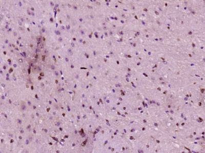 14 - Neurogenin 2 Polyclonal Antibody AP58092