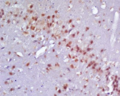 14 - Neurogenin 2 Polyclonal Antibody AP58092