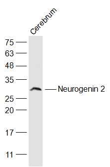1 - Neurogenin 2 Polyclonal Antibody AP58092