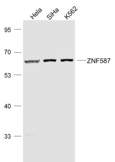 1 - ZNF587 Polyclonal Antibody AP58154