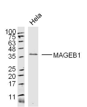 1 - MAGEB1 Rabbit pAb AP58520