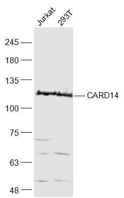 1 - CARD14 Polyclonal Antibody AP58588