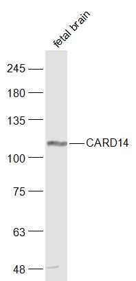 1 - CARD14 Polyclonal Antibody AP58588