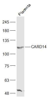 1 - CARD14 Polyclonal Antibody AP58588
