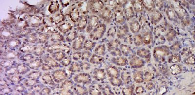 14 - C17orf97 Polyclonal Antibody AP59328
