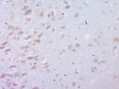 14 - C22orf25 Polyclonal Antibody AP59454