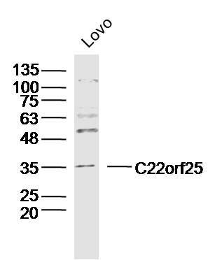1 - C22orf25 Polyclonal Antibody AP59454