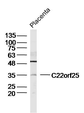 1 - C22orf25 Polyclonal Antibody AP59454