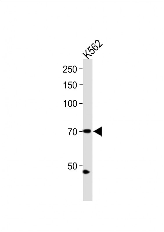1 - ZNF595 Antibody (C-term) AP10304b