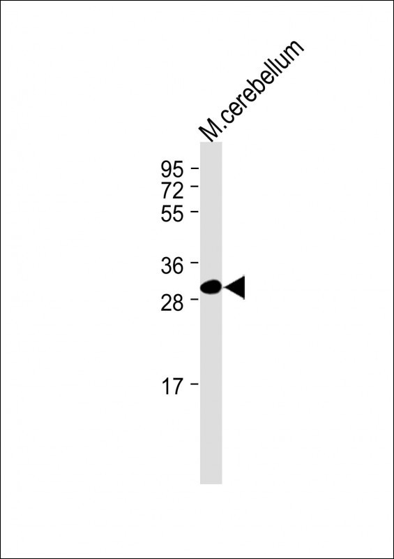 1 - TMEM66 Antibody (N-term) AP10746a