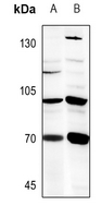 1 - Anti-B4GALNT1 Antibody AP59562